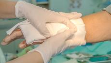 Hands in surgical gloves cover a burn on a patients hand in the hospital.